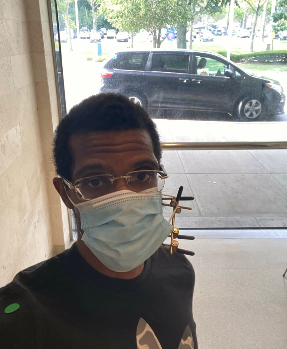 Junard mid-recovery, out in the world wearing a jaw brace